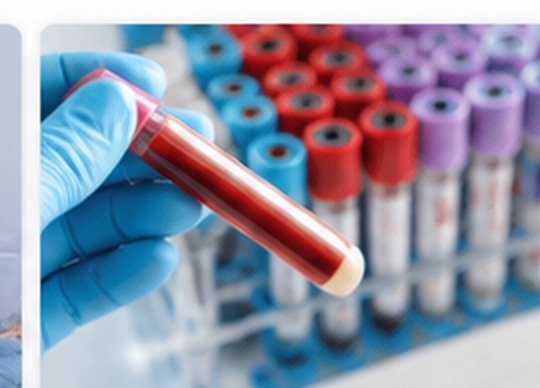 Pathology Tests